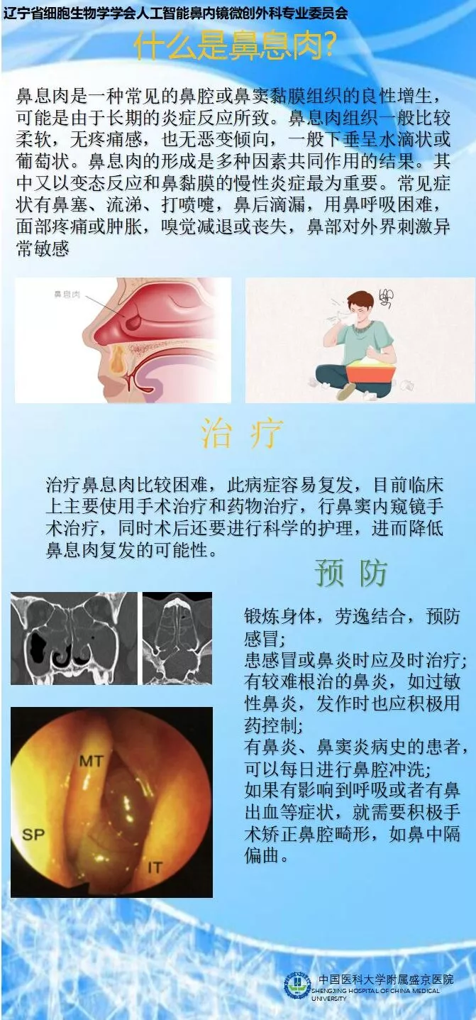 原创科普| 什么是鼻息肉? - 辽宁省细胞生物学学会
